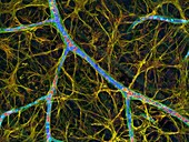 Brain blood vessels, confocal light micrograph