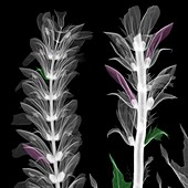 Bear's breeches (Acanthus sp.), X-ray