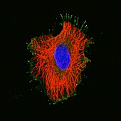 HeLa cell, fluorescent light micrograph