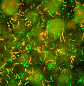 Lyme disease bacteria, immunofluorescent micrograph