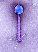 P1 bacteriophage, TEM