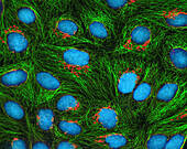 HeLa cells, fluorescence light micrograph
