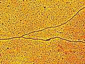 DNA forming a replication fork, TEM