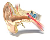 Middle ear infection, illustration