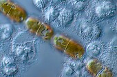 Aulacoseira granulata diatoms, light micrograph