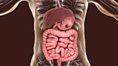 Gastric ulcer, illustration