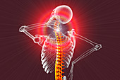 Human neck pain, illustration