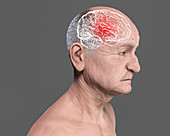 Elderly man's brain in dementia, conceptual illustration