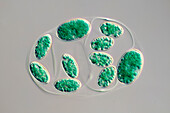 Glaucocystis algae, light micrograph