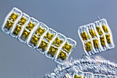 Achnanthes sp. diatoms, LM