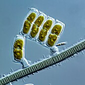 Marine diatoms, LM