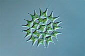 Pediastrum duplex cf. algae, light micrograph