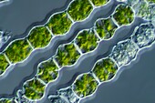 Bambusina sp. green algae, light micrograph