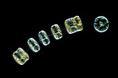 Thalassiosira marine diatoms, light micrograph
