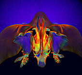 Nasal cavity and sinuses, 3D CT scan