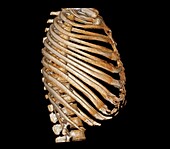 Rib cage, 3D CT scan