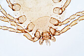 Dust mite, light micrograph