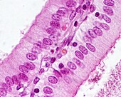 Simple columnar epithelium, light micrograph