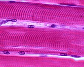 Muscle fibres, light micrograph