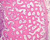 Embryonic bone diaphysis, light micrograph