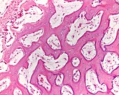 Intramembranous ossification, light micrograph