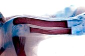 Developing bones of rat leg, light micrograph