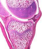 Cartilage perichondrium, light micrograph