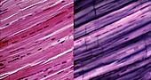 Skeletal muscle fibres, light micrographs