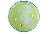 Bacteria sensitivity test