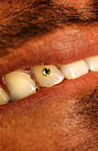 Tooth jewellery