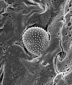 Pollen trapped in mucus on nose hair, SEM