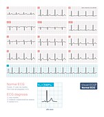 Normal ECG, illustration