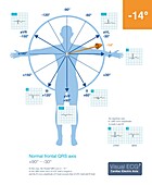 Normal frontal QRS axis, illustration