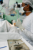 Surgeon uses a microscope during cataract surgery
