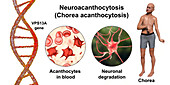 Neuroacanthocytosis, conceptual illustration