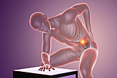 Back pain, illustration