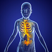 Scoliosis of the spine, illustration