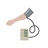 High blood pressure, illustration