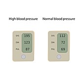 Normal and high blood pressure, illustration