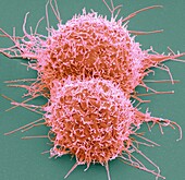 Colorectal cancer cells, SEM