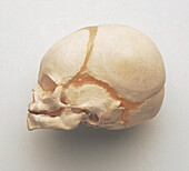 Human fetal skull