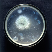 Yeast culture in petri dish