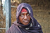 Woman with river blindness