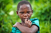 Young girl with facial lesions