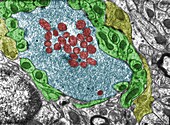 Cerebellar glomerulus, TEM