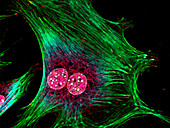 Fibroblasts, fluorescent micrograph