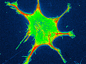 Fibroblast actin heatmap, fluorescent micrograph