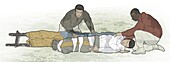 Men putting patient on improvised stretcher, illustration