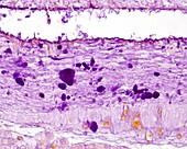 Pituitary gland stalk, light micrograph