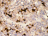 Folliculostellate cells of pituitary gland, light micrograph